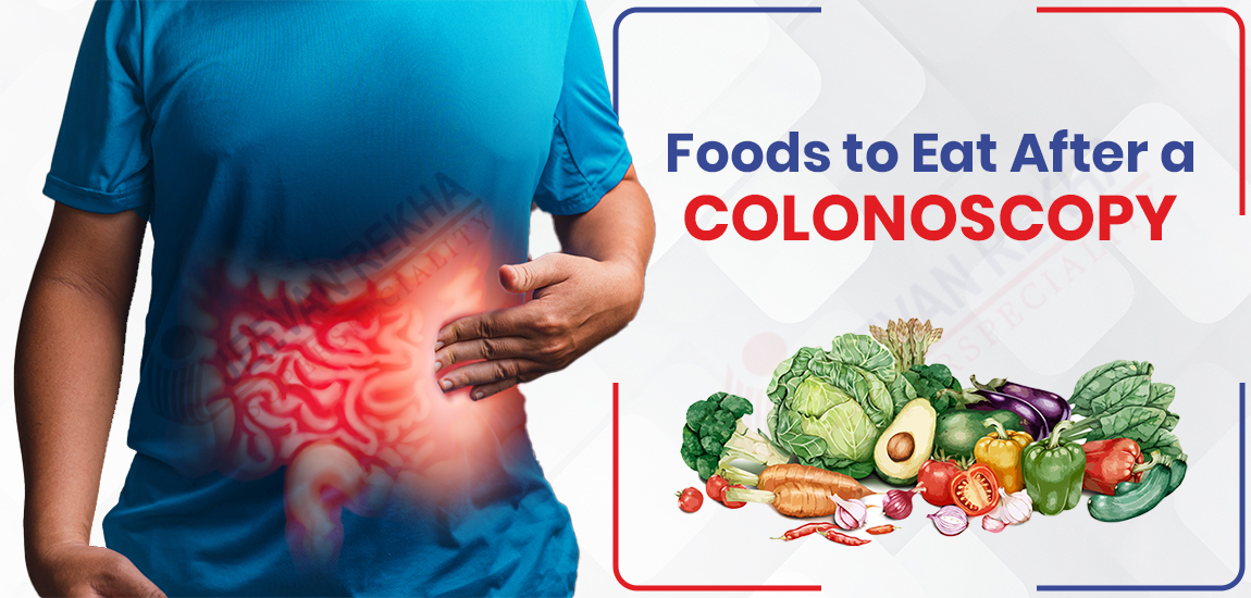 What Foods to Eat After a Colonoscopy: 12 Foods to Eat