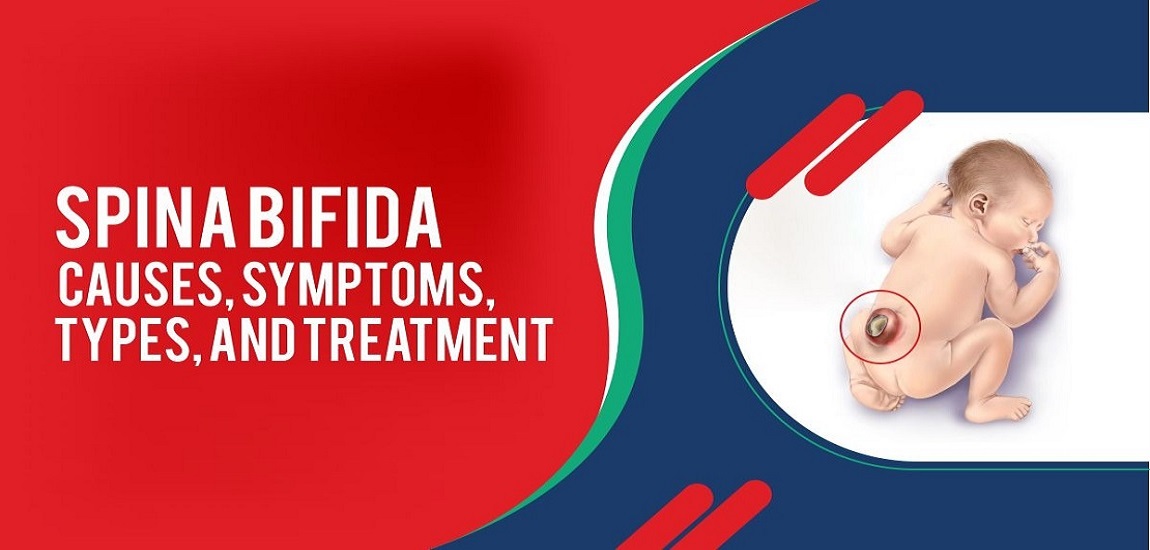 Spina Bifida: Causes, Symptoms, Types, and Treatment