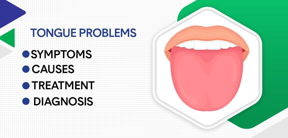 Tongue Problems: Symptoms, Causes, Diagnosis & Treatment