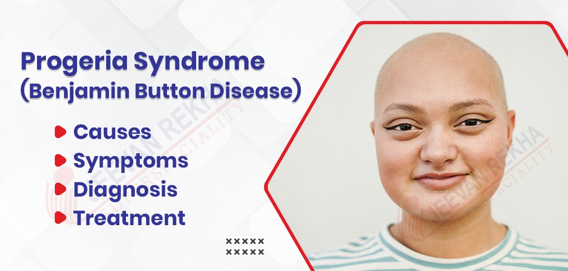 Progeria Syndrome (Benjamin Button Disease): Causes, Symptoms, Diagnosis, and Treatment