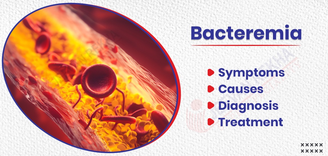 Bacteremia: Symptoms, Causes, Diagnosis, and Treatment