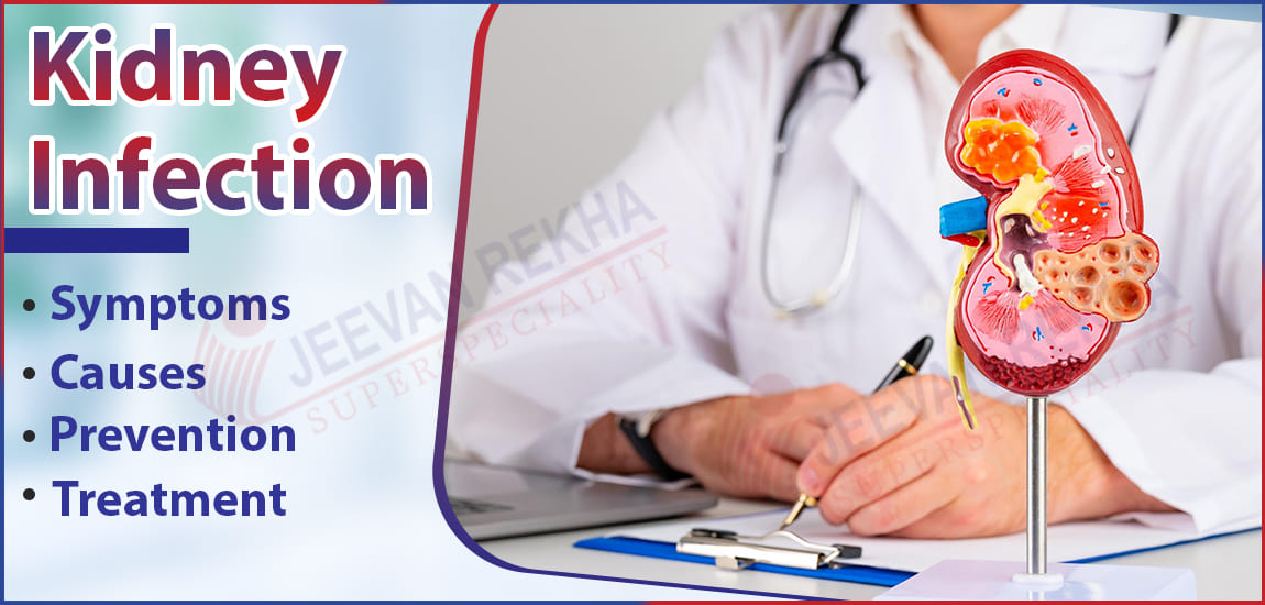 Kidney Infection: Symptoms, Causes, Prevention, and Treatment