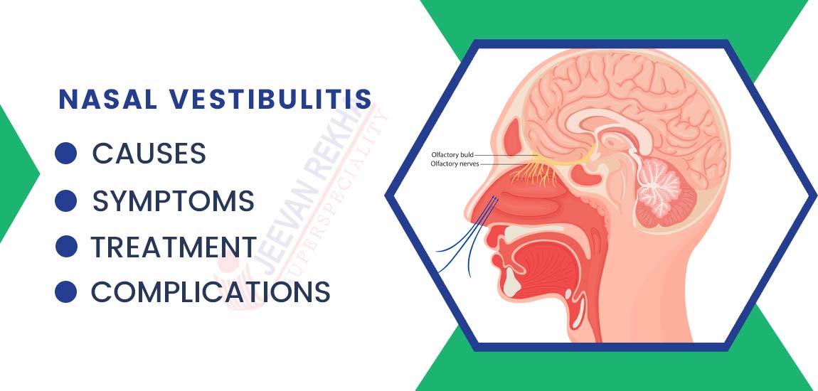 Nasal Vestibulitis: Causes, Symptoms, Complications, and Treatment