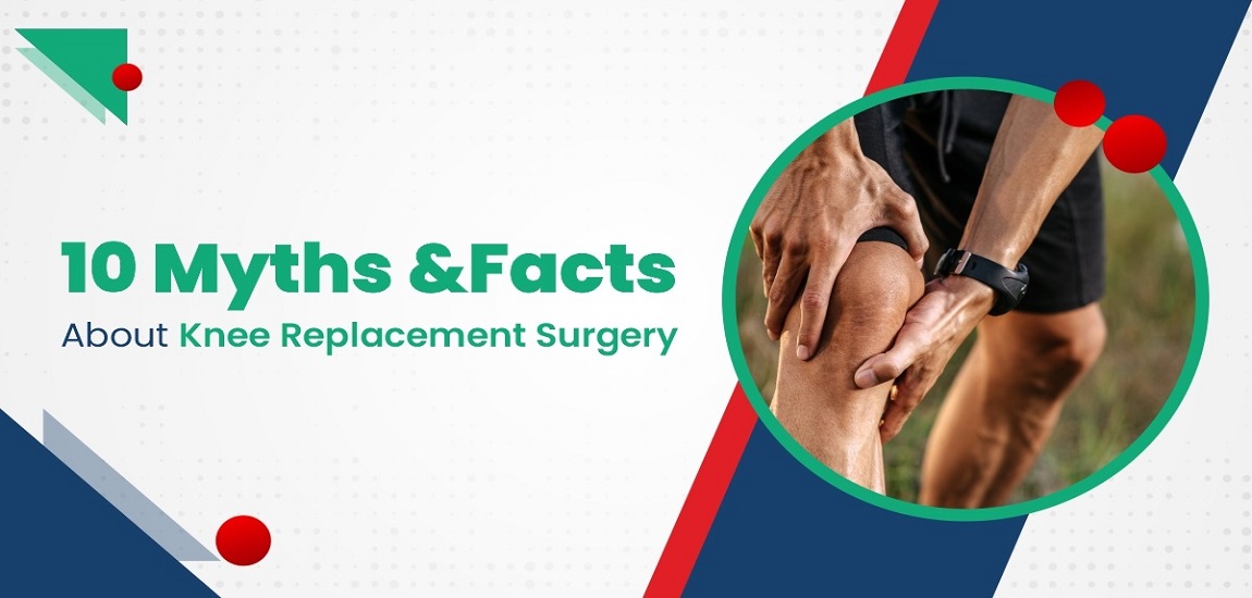 10 Myths and Facts About Knee Replacement Surgery