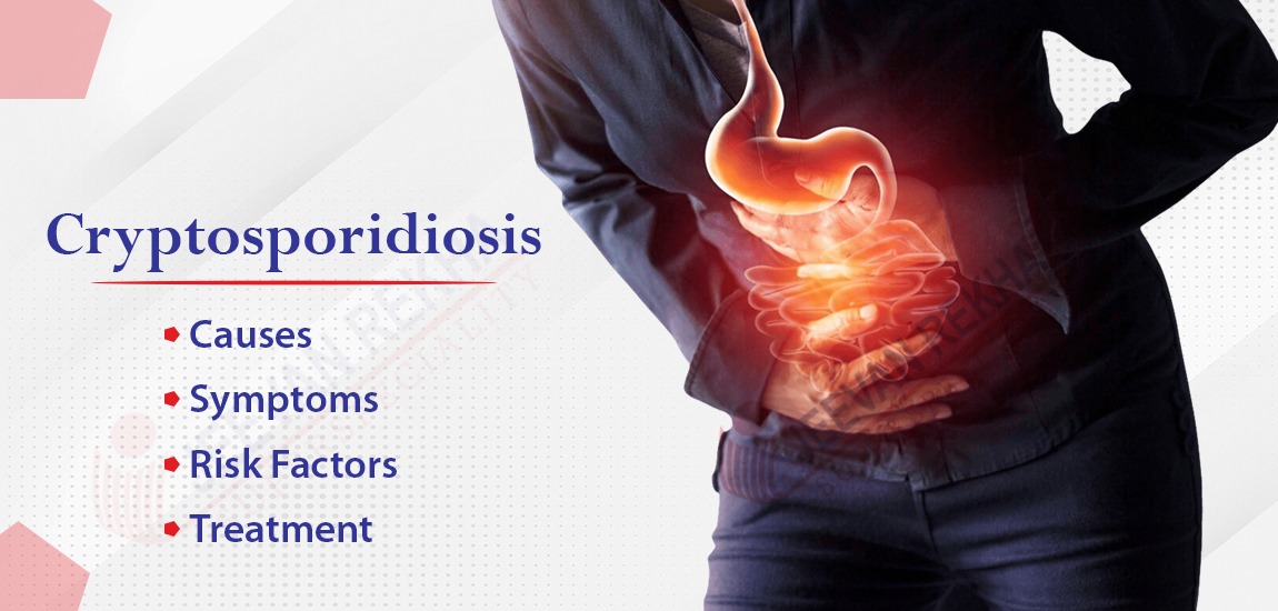 Cryptosporidiosis: Causes, Symptoms, Risk Factors, and Treatment