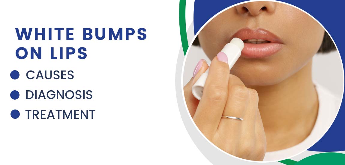 White Bumps on Lips: Causes, Diagnosis, and Treatment