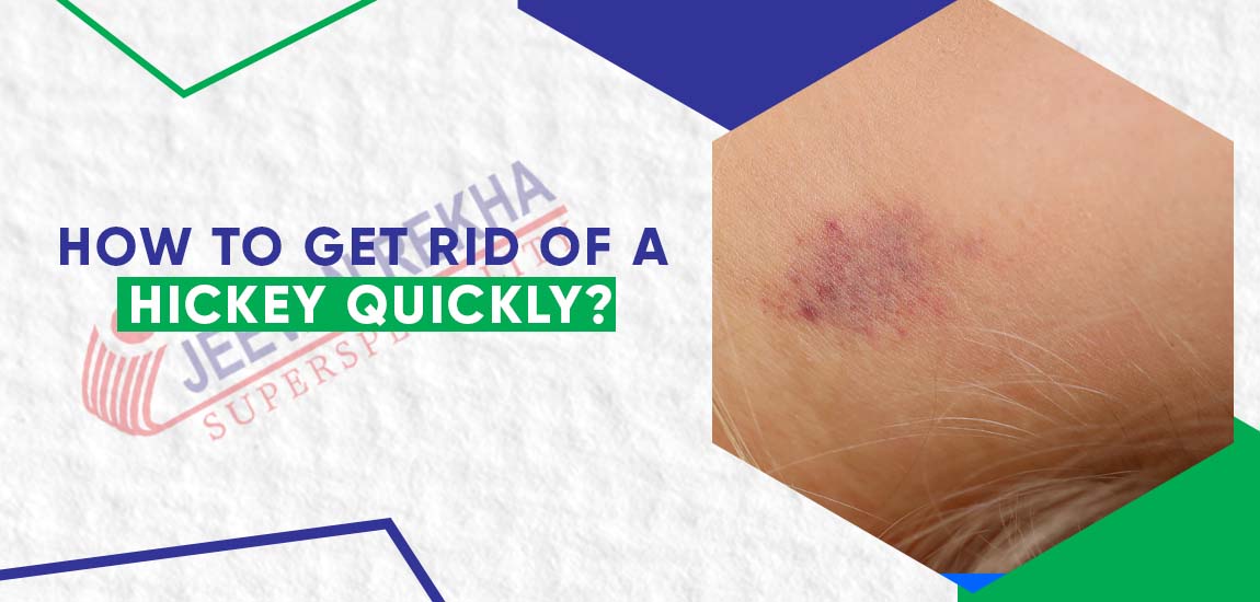 How to Get Rid of a Hickey Quickly? : 12 Tips and Tricks