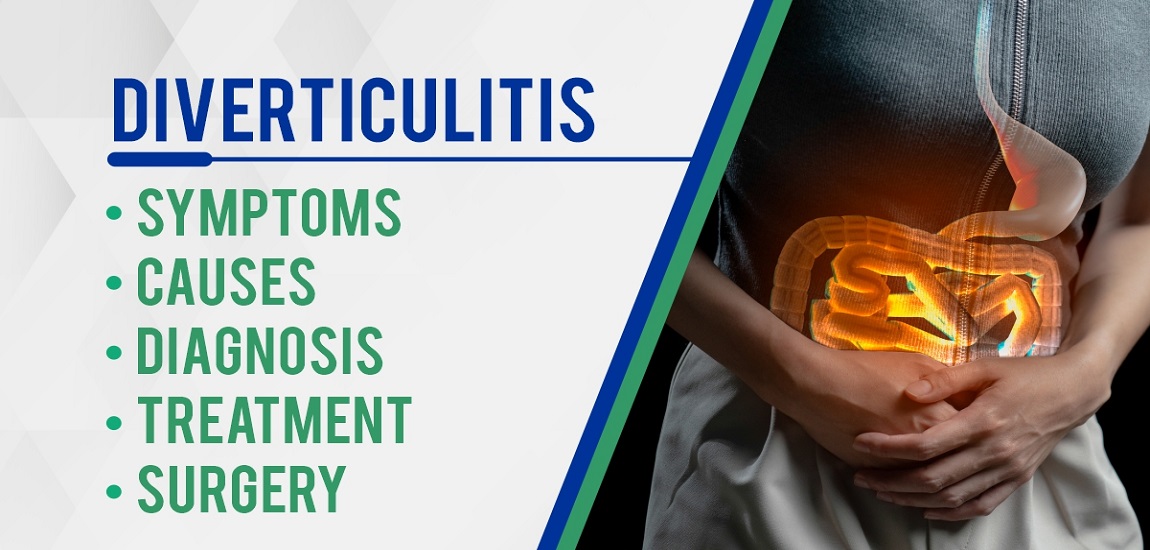 Diverticulitis: Symptoms, Causes, Diagnosis, Treatment, Surgery