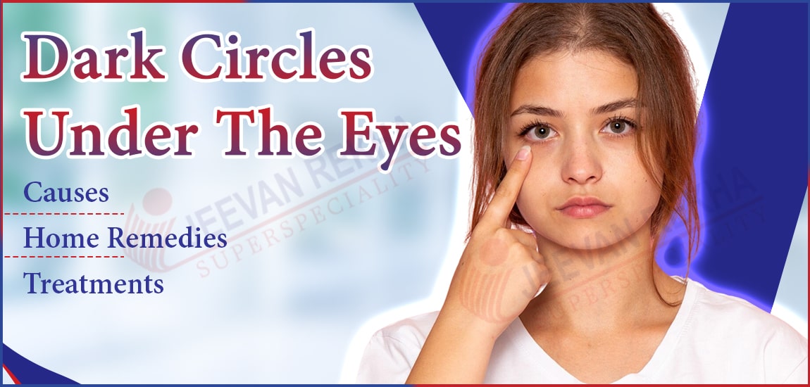 Dark Circles Under The Eyes: Causes, Home Remedies and Treatments