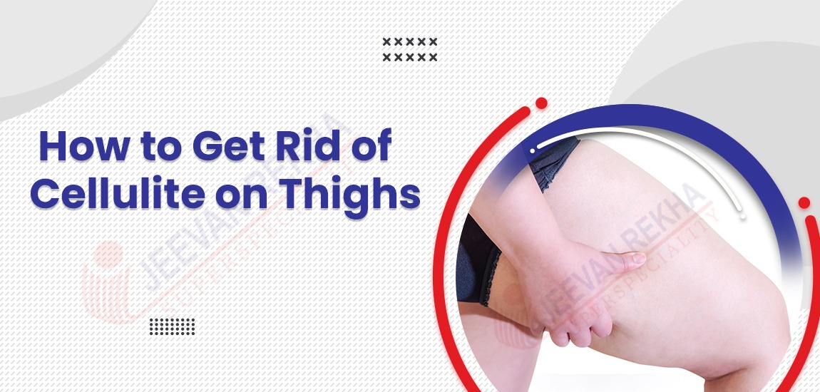 How to Get Rid of Cellulite on Thighs | Cellulite