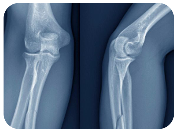 Best Orthopedic hospital in jaipur